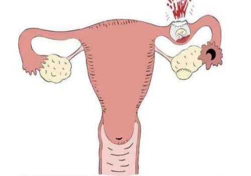 西安试管婴儿价格：什么方式可以检测出自己是否怀孕？哪种方式的检测结果最为准确呢？