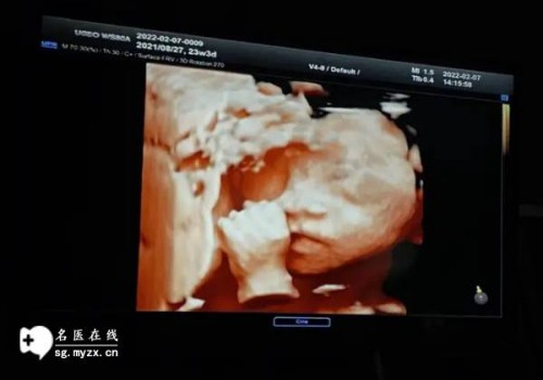 备孕前做好各项检查，时间在备孕前6个月最好