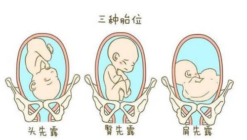 西安供卵试管：赴美生子：十大优势与父母应考虑的风险解析！