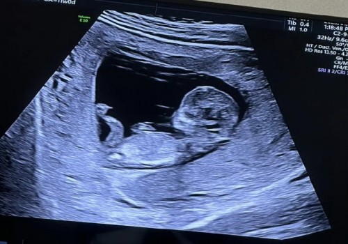 西安供卵试管：2023新余妇幼保健院试管婴儿全方位指南，费用明细及成功率参考