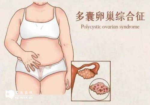 西安正规助孕机构：刚出生不久的婴儿打嗝,宝宝打嗝这样缓解