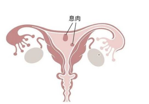 试管取卵后要注意什么,试管取卵后有哪些需要忌口的
