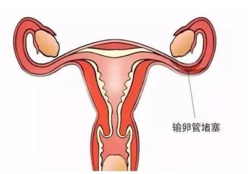 尿不湿过期了还能用吗？用尿不湿不注意这些事情可能会危害宝宝身体
